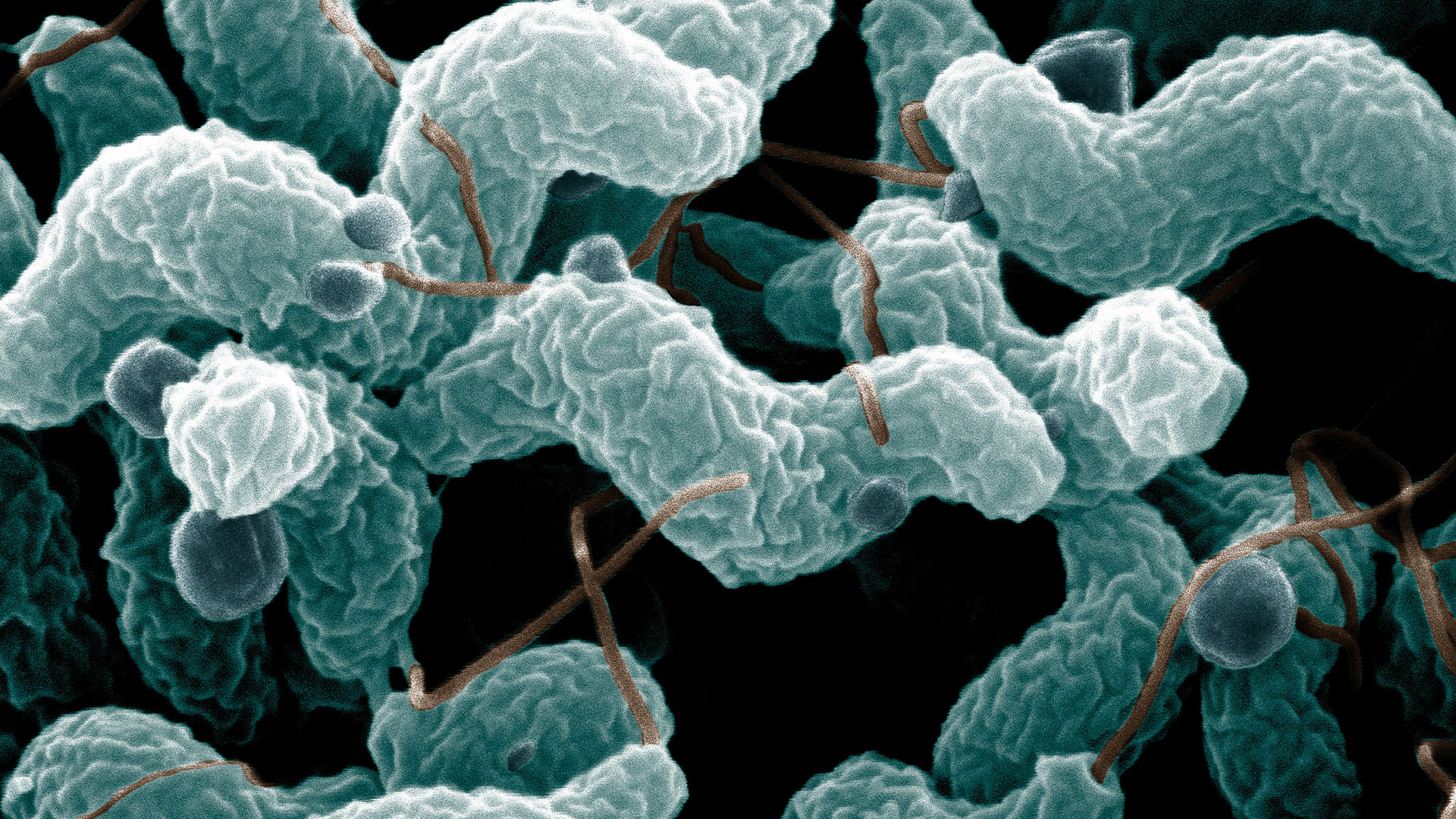 Electron microscope image of a campylobacter bacteria. Credit: De Wood, Pooley, USDA, ARS, EMU., Public domain, via Wikimedia Commons